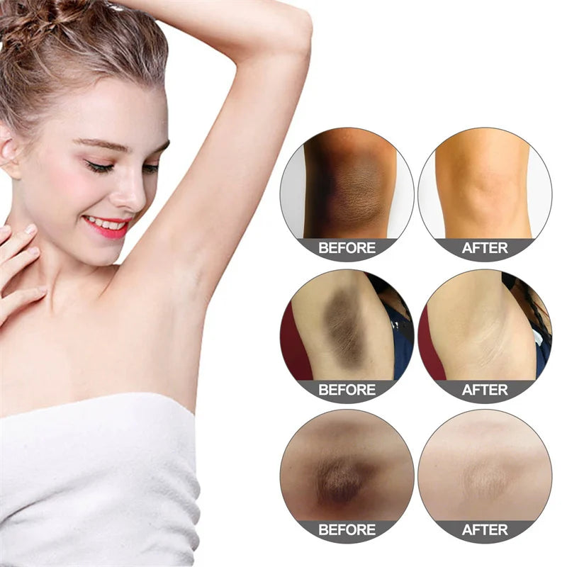 Nicotinamide Brightening Cream For Dark Skin Effective Lighten Thigh Inner Bleach Remove Melanin Private Parts Brighten Cream