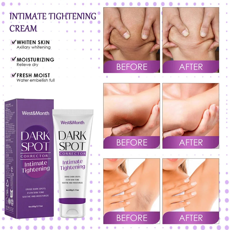 Nicotinamide Brightening Cream For Dark Skin Effective Lighten Thigh Inner Bleach Remove Melanin Private Parts Brighten Cream
